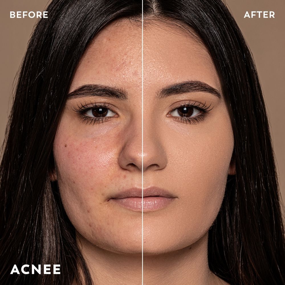 Before / After fond de ten Cupio Cinematic