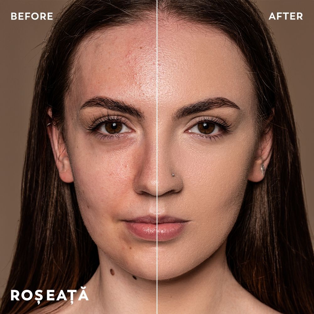 Before / After fond de ten Cupio Cinematic — roșeață